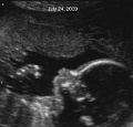 21.2a_090811